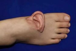 Người phụ nữ 'mọc' tai trên bàn chân và sự thật bất ngờ