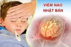 Xuất hiện các ca viêm não Nhật Bản, cảnh báo biến chứng nghiêm trọng
