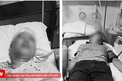 Xác minh vụ 2 người đàn ông bị nhóm người nghi là bảo vệ chung cư hành hung bằng hung khí