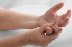 Trời nóng kéo dài, bác sĩ lưu ý 4 dấu hiệu đột quỵ không nên bỏ qua