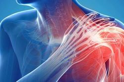 Nhiều ca bệnh khớp hiếm gặp được điều trị thành công