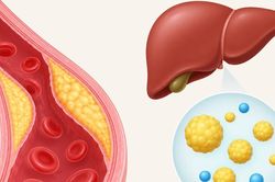 Cách kiểm soát cholesterol hiệu quả