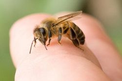 Kịp thời cứu sống bệnh nhi bị ong vò vẽ đốt gây sốc phản vệ nặng