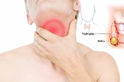 Nhận diện sớm ung thư tuyến giáp để bảo vệ sức khỏe lâu dài