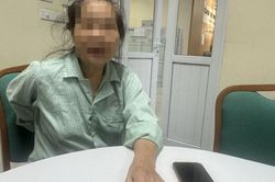 Đau lưng âm ỉ suốt nhiều năm, người phụ nữ 63 tuổi bất ngờ phát hiện mang 4 quả thận bẩm sinh