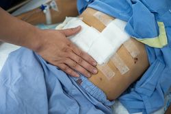 Căn bệnh tuổi trung niên đang âm thầm tấn công người trẻ
