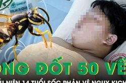 Bị ong vò vẽ đốt hơn 50 vết, thiếu niên 14 tuổi hoại tử, sốc phản vệ nguy kịch