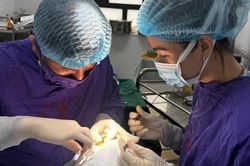Dập nhãn cầu, rơi thủy tinh thể vì cú đập cầu lông