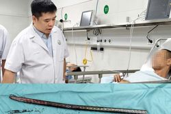 Xuy&ecirc;n đ&ugrave;i bởi x&agrave; beng 1,5m: Ca cấp cứu c&acirc;n n&atilde;o tại Bệnh viện Việt Đức