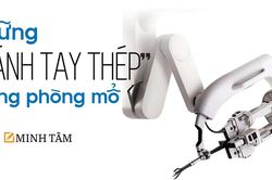 Những 'cánh tay thép' trong phòng mổ