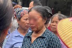 Tranh chấp chỗ bán hàng, một phụ nữ bị xịt nước cao áp đến chảy máu mắt