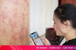Mỹ phẩm online: Dễ mua - khó kiểm chứng chất lượng