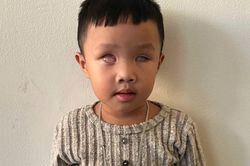 Mở rộng lòng từ: Bé bị ung thư mù hai mắt