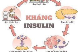 Omega-7 có giúp cải thiện đề kháng insulin và sức khỏe chuyển hóa?