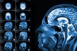 Phát hiện về khả năng não bộ từ thí nghiệm đọc