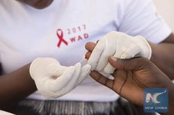 Liên hợp quốc kêu gọi đẩy nhanh tiến độ chấm dứt đại dịch AIDS toàn cầu
