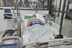 Cứu nam công nhân bị tai nạn chấn thương sọ não nặng