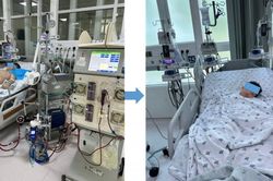 Từ cơn cảm sốt nhẹ, bé trai 11 tuổi viêm cơ tim nguy kịch: Bác sĩ cảnh báo sai lầm nhiều phụ huynh mắc phải