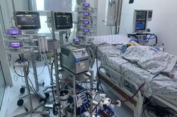 T&aacute;c nh&acirc;n phổ biến nhất g&acirc;y vi&ecirc;m m&agrave;ng n&atilde;o vi khuẩn ở trẻ nhỏ