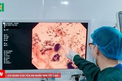 Vì người Việt và hành trình đưa Endocyto 520x về nước của Thu Cúc TCI