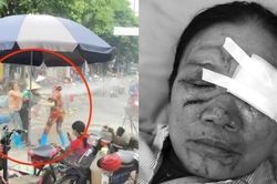 Liên tiếp xảy ra vụ xịt vòi nước cao áp vào người khác, luật sư nói gì?