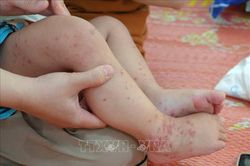 Chủ động chống dịch bệnh gia tăng và lây lan trong mùa mưa