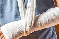 G&atilde;y xương ở trẻ dịp h&egrave;: Đừng chủ quan sau chấn thương