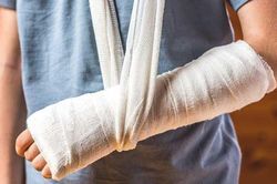 Gãy xương ở trẻ dịp hè: Đừng chủ quan sau chấn thương
