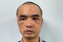Đối tượng ph&aacute; k&iacute;nh nhiều &ocirc; t&ocirc; để ở đường V&otilde; Ch&iacute; C&ocirc;ng khai g&igrave;?