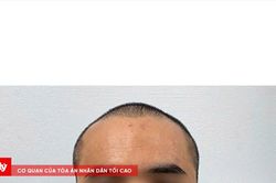 Lời khai đối tượng đuổi ch&eacute;m người đi đường, đập ph&aacute; &ocirc; t&ocirc;