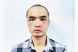 L&yacute; lịch của đối tượng cầm dao ch&eacute;m nhiều &ocirc; t&ocirc; ở H&agrave; Nội