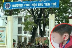 Bắc Ninh: Học sinh bị thầy giáo véo tai đến chảy máu