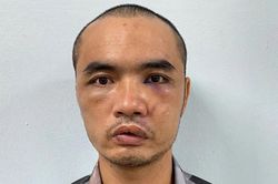 Tạm giữ khẩn cấp 01 đối tượng phá hoại nhiều ô tô