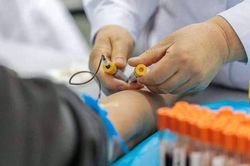 Bác sĩ nhắc nhở: Nếu cánh tay xuất hiện 4 dấu hiệu này, đừng chần chừ đi khám