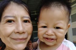 Cô gái có gương mặt như bà cụ, con cũng mắc bệnh lão hóa sớm