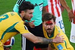 Rách mặt vẫn chiến đấu, Metcalfe khiến World Cup dậy sóng