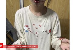Điều tra vụ cô gái bị hành hung, nghi sàm sỡ ngay trước cửa nhà