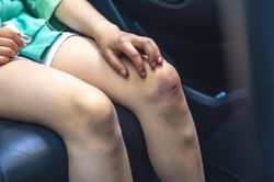Dấu hiệu có thể là cảnh báo xơ gan giai đoạn đầu