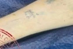Cảnh s&aacute;t truy t&igrave;m lai lịch thi thể c&oacute; h&igrave;nh xăm vương miện tr&ecirc;n c&aacute;nh tay