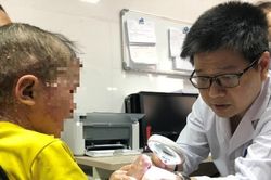Gieo hy vọng cho những phận đời yếu thế B&agrave;i 1: Lặng thầm xoa dịu nỗi đau vảy nến