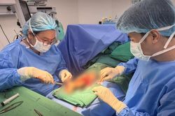Suýt mất cả chân sau tai nạn giao thông, cô gái 21 tuổi được cứu bằng kỹ thuật lấy da từ da đầu