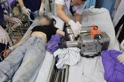 C&ocirc; g&aacute;i 19 tuổi nguy cơ mất b&agrave;n tay vĩnh viễn v&igrave; sơ suất trong l&uacute;c d&ugrave;ng m&aacute;y xay