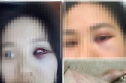 Sở GD&ĐT Hà Tĩnh vào cuộc làm rõ vụ giáo viên bị tố ngoại tình, bạo hành vợ