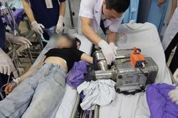 Một phút bất cẩn, cô gái 19 tuổi đối mặt biến cố lớn