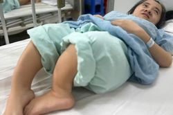MS 1095: Xót thương gia cảnh cô gái mắc bệnh xương thủy tinh, cha bị liệt sau tai nạn