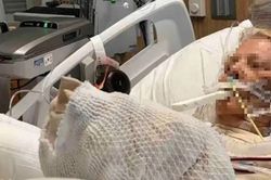 Người phụ nữ 82 tuổi suýt chết vì ngủ ngoài trời nắng theo cách 'vạn người mê'