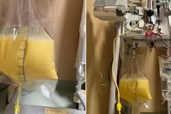 Người phụ nữ 32 tuổi 'máu trắng đục như sữa' vì thứ quen thuộc trong tủ thuốc