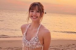 Lisa bị nghi 'dao kéo'