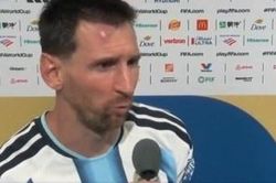 Trán Messi sưng vù sau trận thắng Cape Verde