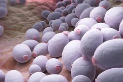 Đau rát vùng miệng, lưỡi kéo dài cảnh giác với nấm miệng họng do Candida